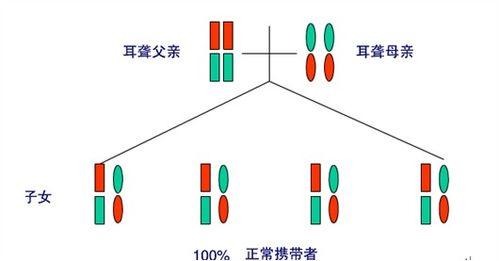 遗传性耳聋,遗传性耳朵聋基因检测杂合突变